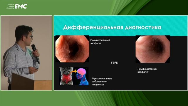 5. Старченков Д.Д., Агейкина Н.В. ГЭРБ: нетривиальная роль эндоскописта в диагностике заболевания