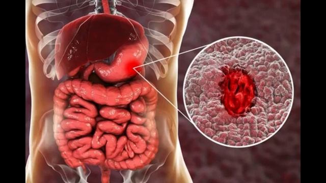 8 класс биология. ЖКТ. Азади.Д 8"З" смотреть онлайн