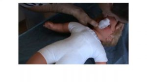 Особенности реанимации у детей