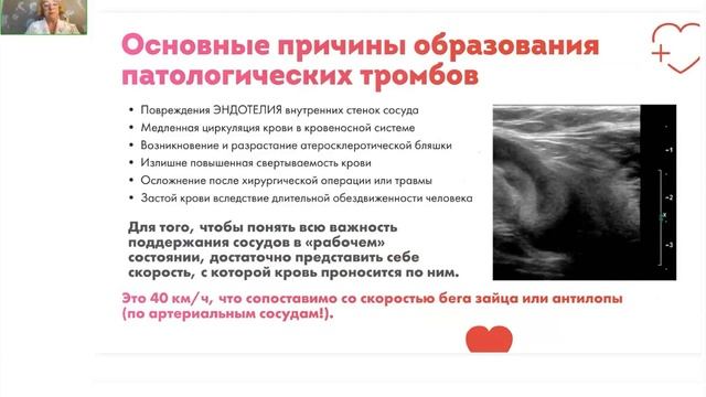 ★[ Талассопитание как базис ангиореабилитации] смотреть онлайн