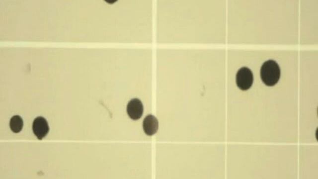 2 Форменные элементы крови и счёт смотреть онлайн