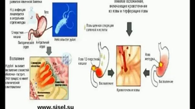 'Заболевания органов пищеварения'