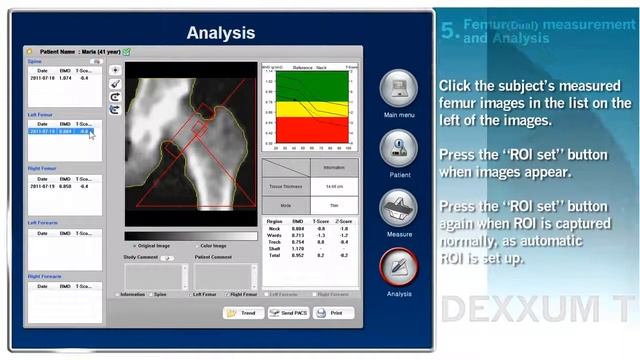 Рентгеновский костный денситометр DEXXUM 3 Osteosys смотреть онлайн