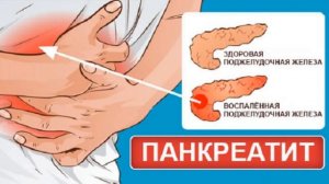 ДИЕТА ПРИ ХРОНИЧЕСКОМ ПАНКРЕОТИТЕ.