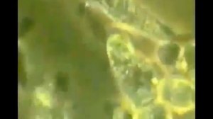 Лейкоциты разрывают раковую клетку