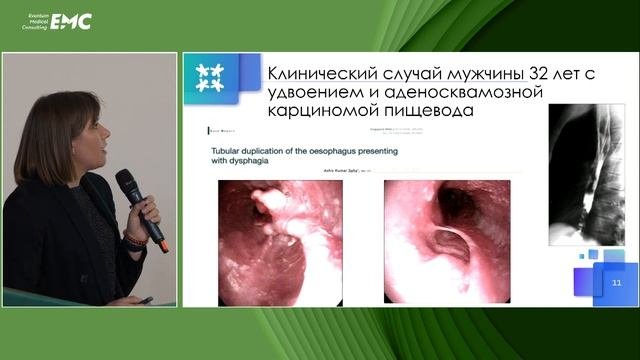 1 Клинический случай врожденного порока ЖКТ. Подлипаева С.Г, Петров Д.А, Макаров С.П, Андреев Е.С.
