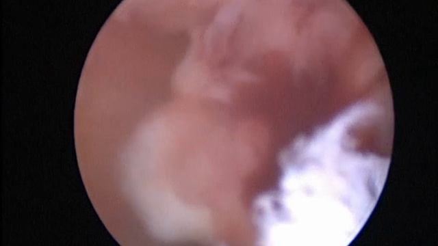 Артроскопия у собаки и крючковидный отросток локтевой кости. Курган. Эндовет смотреть онлайн