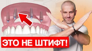 ПОЧЕМУ ШТИФТЫ - ЭТО НЕ ИМПЛАНТЫ. В ЧЕМ РАЗНИЦА? ЧТО ВЫБРАТЬ?