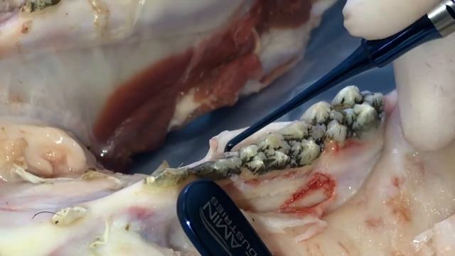 Кюрета-скейлер Blue смотреть онлайн