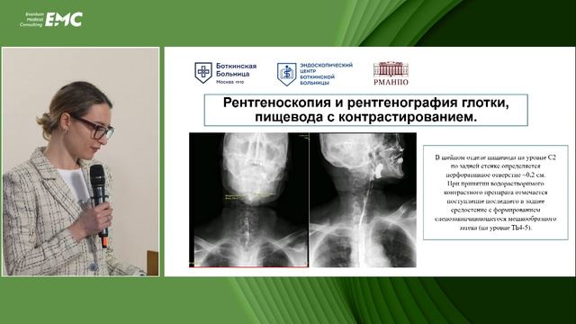 5. Первый опыт лечения полностенного дефекта ротоглотки методом отрицательного давления. Амирова ВВ