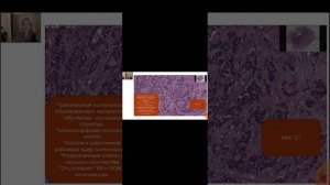 Инвазивнаяя карцинома