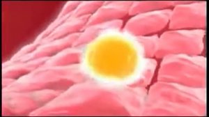 Патогенез рассеянного склероза