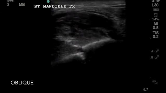 18 yo Male Multiple Punches to the Jaw смотреть онлайн