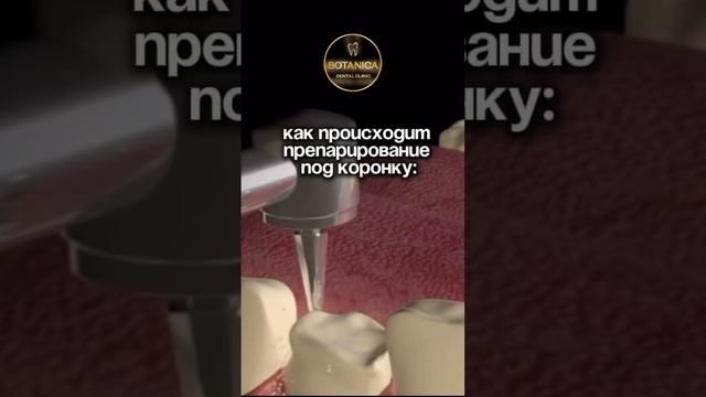 Как происходит препарирование под коронку? #стоматологиямосква