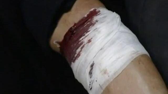 Meteorite consequences in Russia, injured/Раненые от метеорита, НЕ ДЛЯ СМИ смотреть онлайн