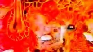 Иммунитет и раковые клетки  Как укрепить, повысить, восстановить иммунитет