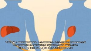 Лечение фиброза печени 4 степени