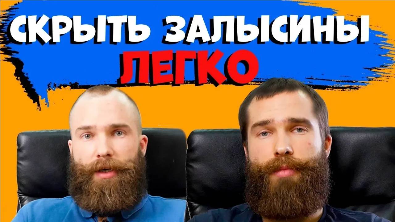Как скрыть лысину и залысины на лбу? Прическа с лобными залысинами смотреть онлайн
