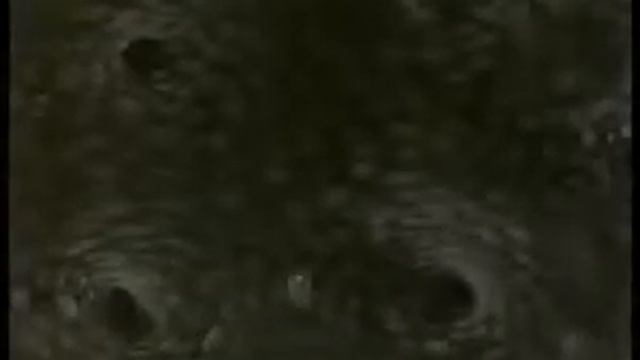 Анатомия человека Пищеварение в желудке смотреть онлайн