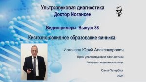 УЗИ . Доктор Иогансен. Видеопримеры. Выпуск 88. Кистозно-солидное образование яичника.