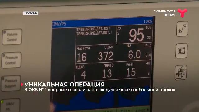 Резекция желудка через небольшой прокол