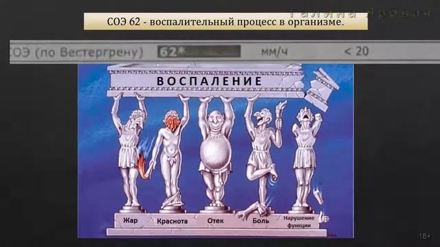 📹 4 часть. Пример грамотной ликвидации скрытого голода смотреть онлайн