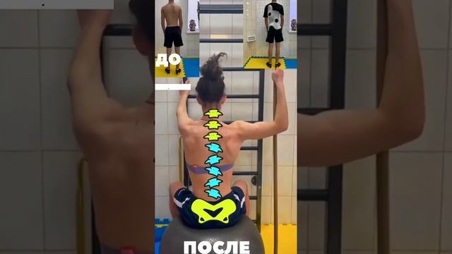 ИНТЕНСИВ ПО 3D КОРРЕКЦИИ СКОЛИОЗА  #лфк #реабилитация #упражнениядляспины #позвоночник #шрот