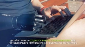 Функциональный протез руки «Киби»