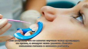 Герметизация фиссур у детей