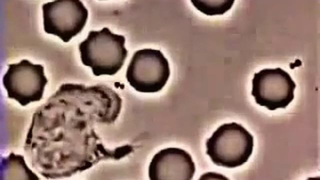 Иммунитет  Лейкоцит преследует и пожирает бактерию золотистого стафилококка