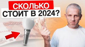 Сколько стоит установка 1 зубного импланта в 2024 году?