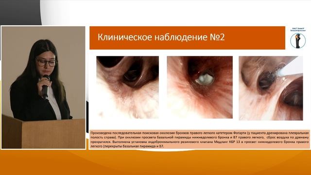 2. Мокрышева Н.Г. Опыт применения одноразовых бронхоскопов в условиях многопрофильного стационара