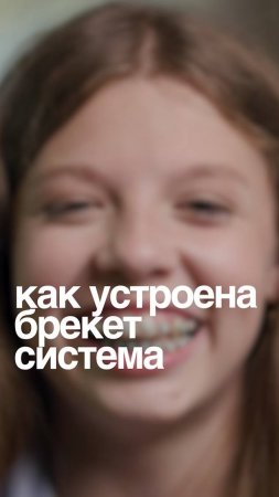 Как устроена брекет-система?✨ #брекеты #элайнеры #ортодонт #стоматология