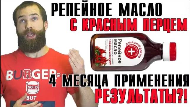 РЕЗУЛЬТАТЫ РЕПЕЙНОГО МАСЛА для бороды от подписчика. Репейное масло для бороды. смотреть онлайн