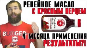 РЕЗУЛЬТАТЫ РЕПЕЙНОГО МАСЛА для бороды от подписчика.  Репейное масло для бороды.