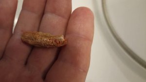 КАМЕНЬ ИЗ МОЧЕВОГО ПУЗЫРЯ ВЫШЕЛ