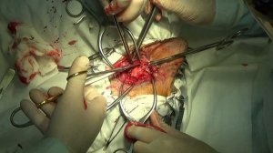 Удаление слухового прохода у собаки