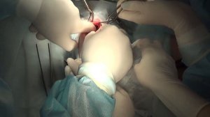 Перитонеоперикардиальная грыжа у кошки