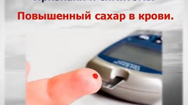 АКРОМЕГАЛИЯ  Как распознать редкое заболевание