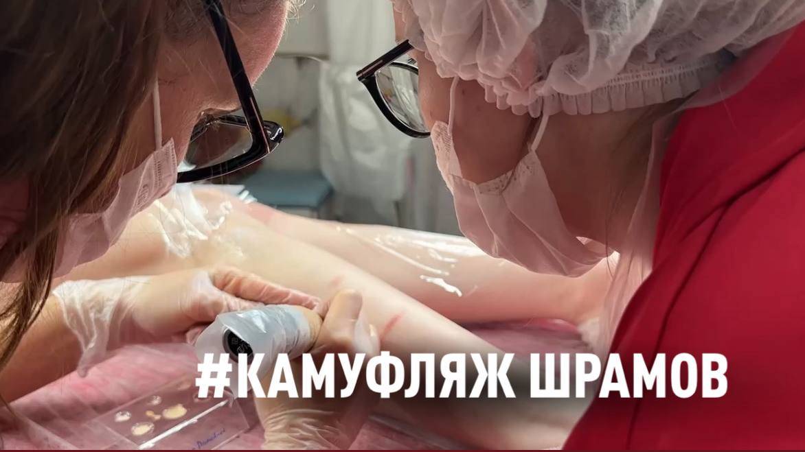 Камуфляж рубцов на ногах