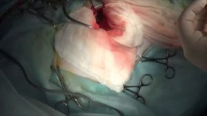 Хирургическое лечение кифотической деформации грудного отдела позвоночника у собак