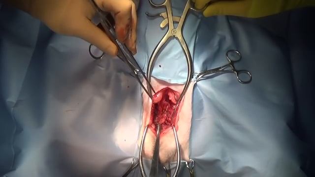 Дисплазия тазобедренных суставов - хирургическая техника лонного симфизиодеза у собак смотреть онлайн