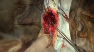 Хирургическая техника холецистэктомии у собак