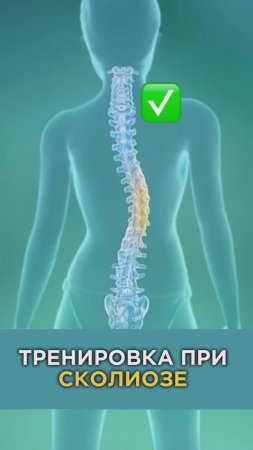 ЛEЧИTE СКОЛИОЗ ГОДАМИ - и не видите результатов?