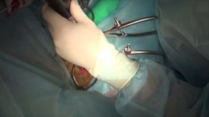 Хирургическое лечение перелома 42В1 у собаки