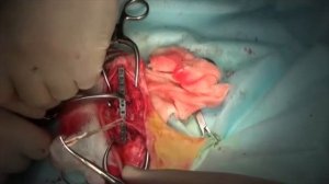 Хирургическое лечение перелома 42В1 у собаки на фоне иммуносупрессивной терапии