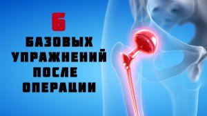 Базовые движения в первый день после операции