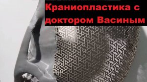 Краниопластика с доктором Васиным