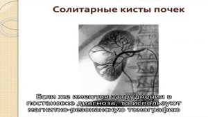 Что такое солитарная киста почки