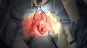 Пертонео-перикардиальная грыжа у кошки